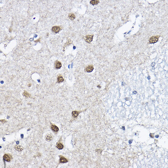 ORC6L Antibody
