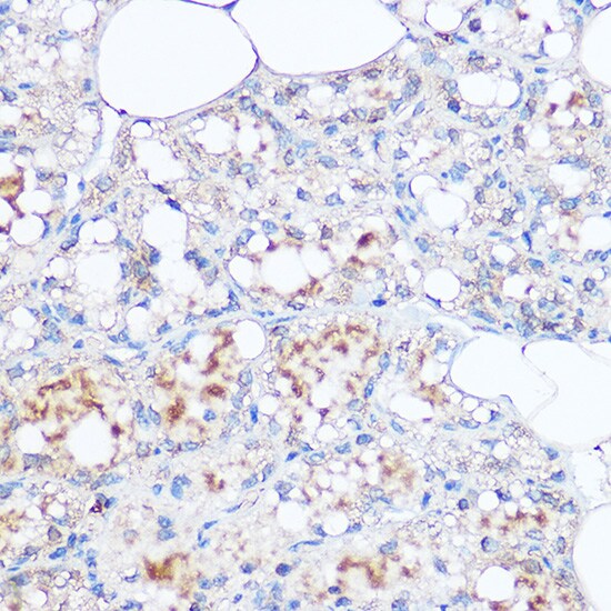 MGP Antibody