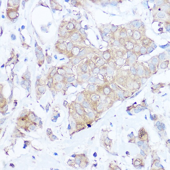MGP Antibody
