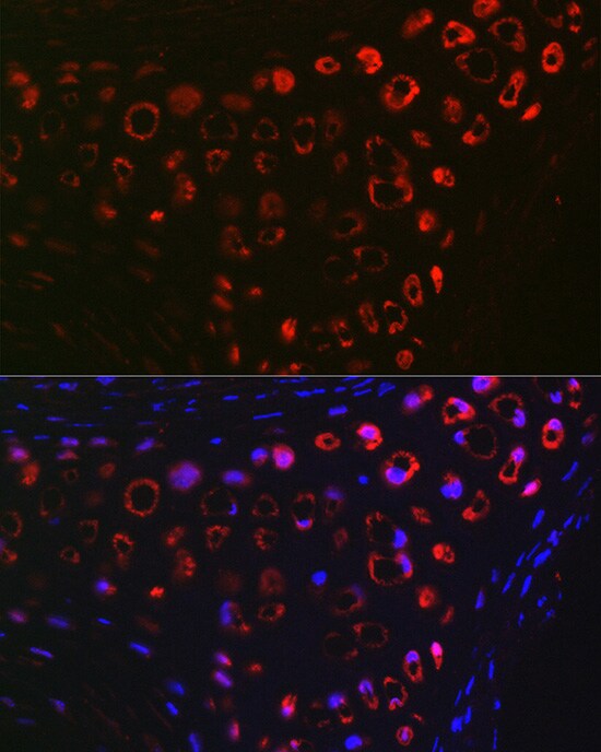 MGP Antibody