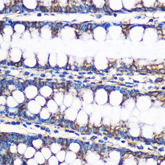 ERAB Antibody