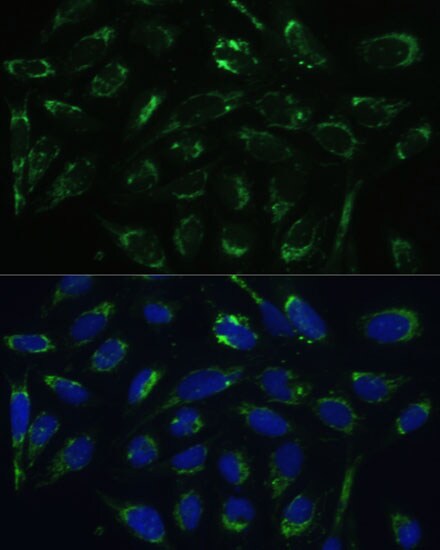 ERAB Antibody