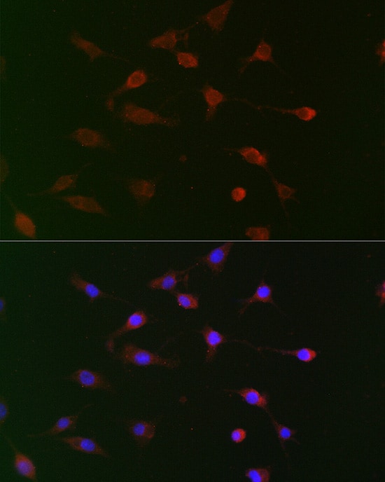 UBE2R1/CDC34 Antibody