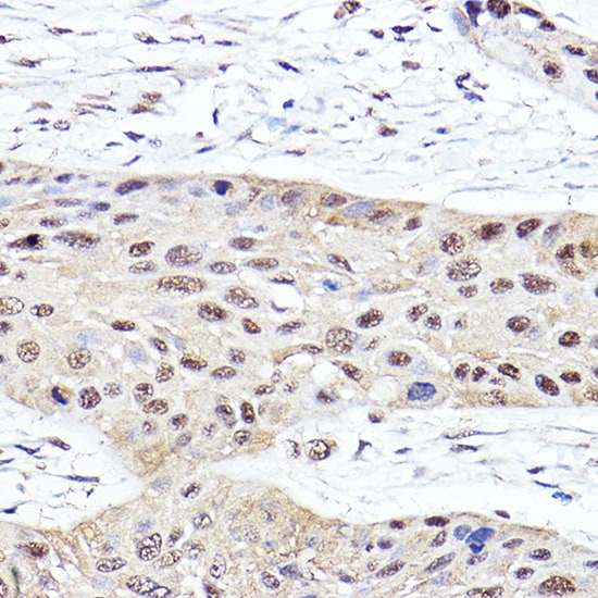 Proteasome 20S beta2 Antibody