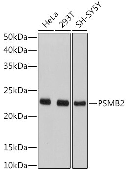 Proteasome 20S beta2 Antibody
