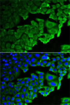 RPLP0 Antibody