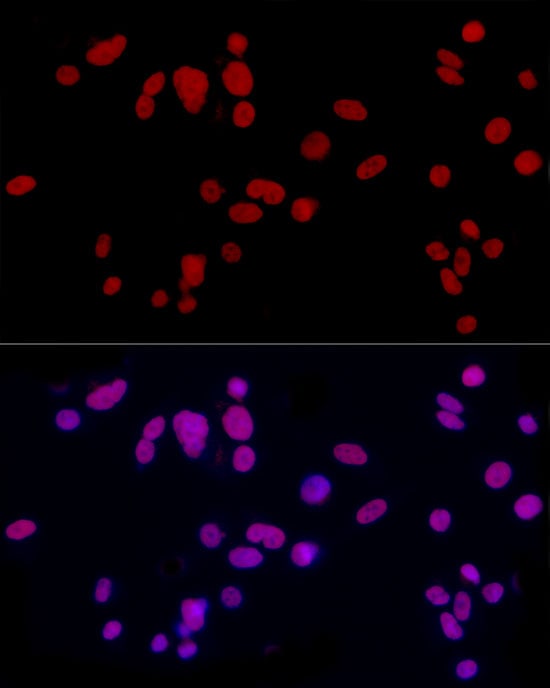 CREM Antibody
