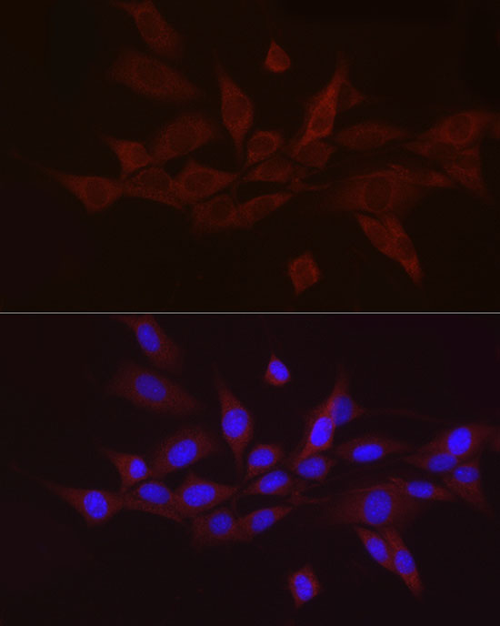 GnRH Antibody