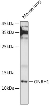 GnRH Antibody