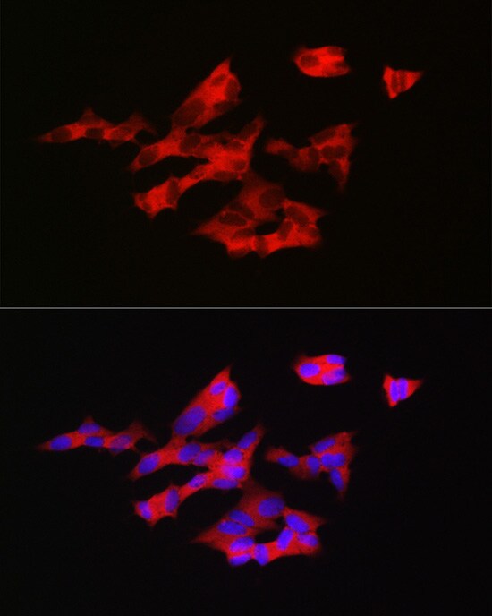GnRH Antibody