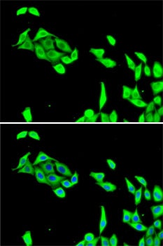 Cdk5 Antibody