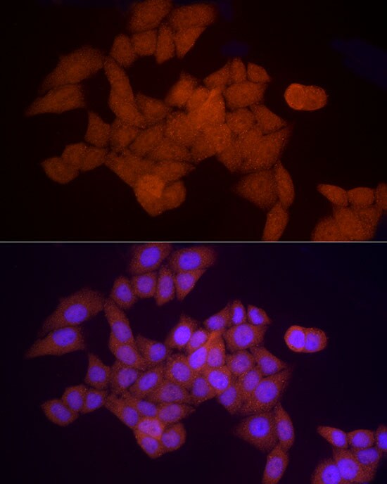 Proteasome 20S alpha 5 Antibody