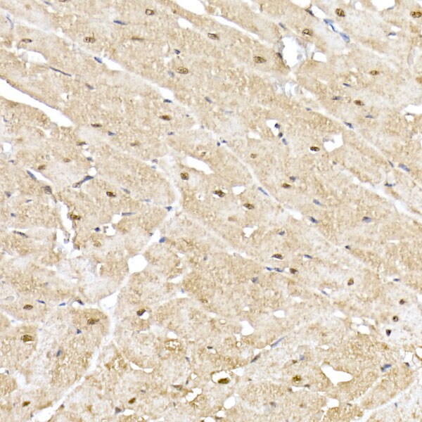 Proteasome 20S alpha 5 Antibody