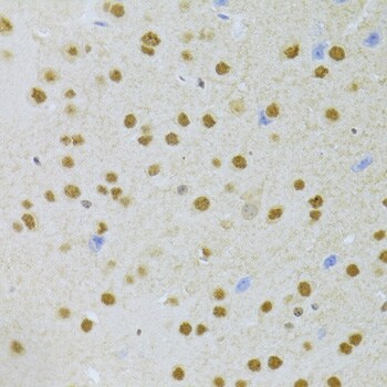 ANP32A Antibody