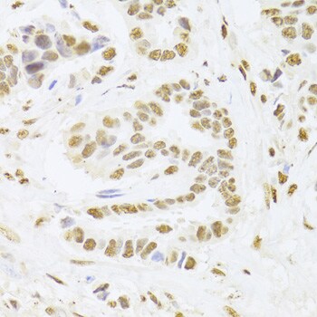 ANP32A Antibody
