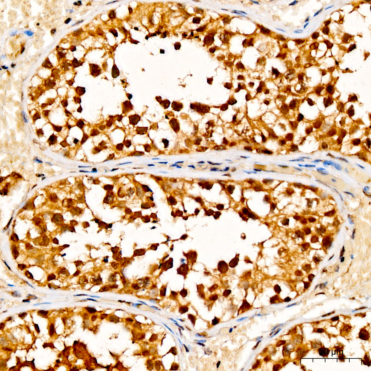GSTO2 Antibody