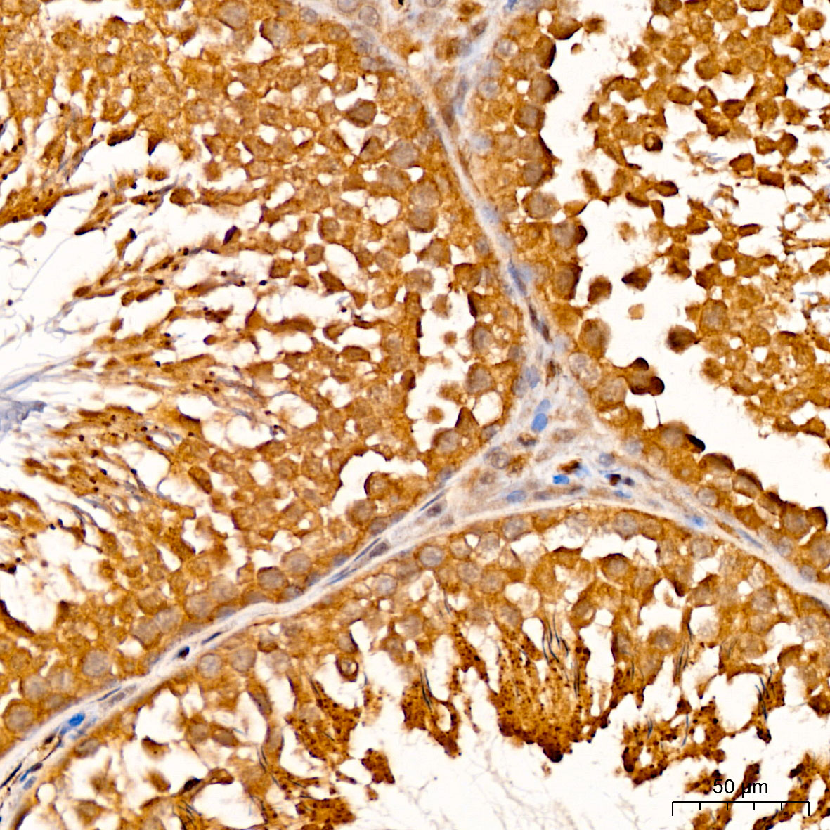 GSTO2 Antibody