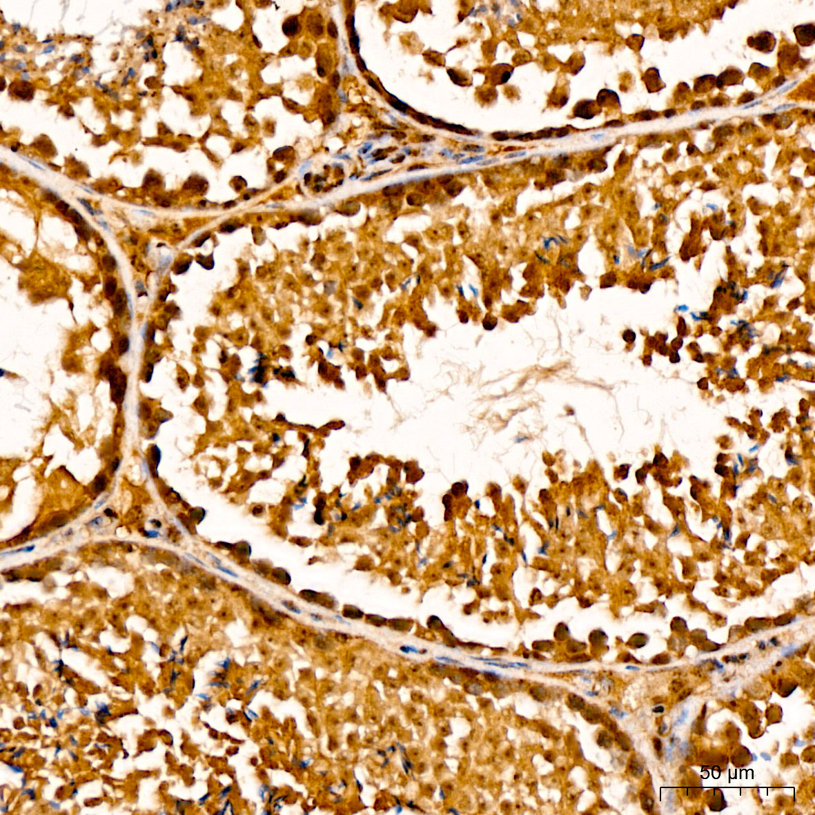 GSTO2 Antibody