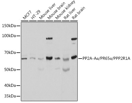 PPP2R1A Antibody