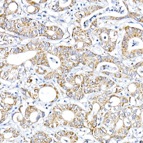 PTPIP51 Antibody