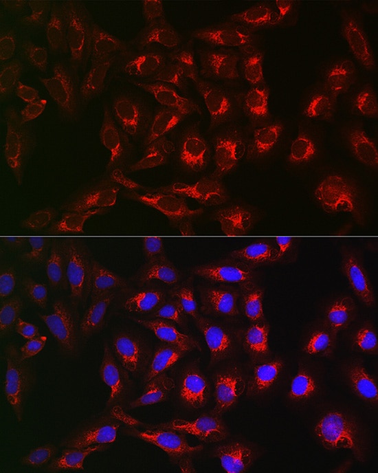 PTPIP51 Antibody