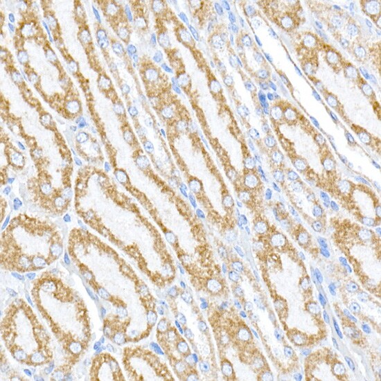 PTPIP51 Antibody
