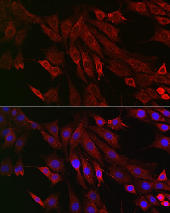 PTPIP51 Antibody