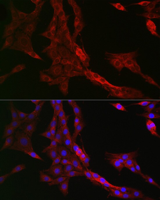 PTPIP51 Antibody
