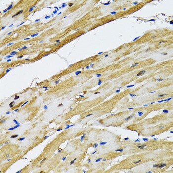 Aspartate Aminotransferase Antibody