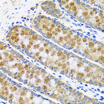 Aspartate Aminotransferase Antibody