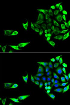 Aspartate Aminotransferase Antibody