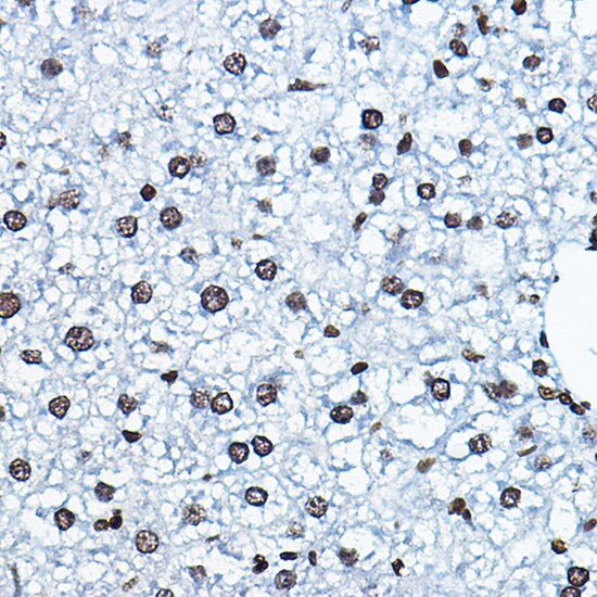 HBO1 Antibody