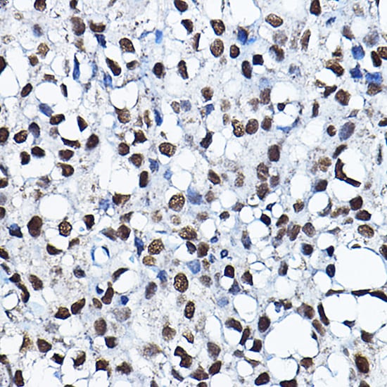 HBO1 Antibody