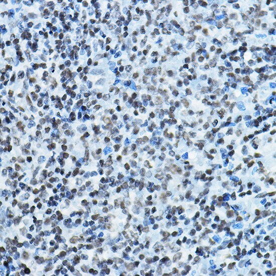 HBO1 Antibody