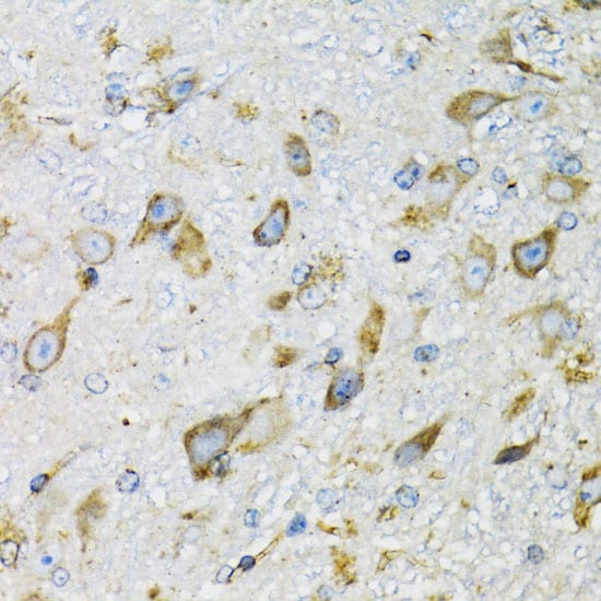 Prodynorphin/PDYN Antibody