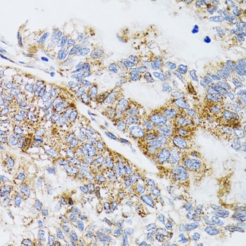 Prodynorphin/PDYN Antibody