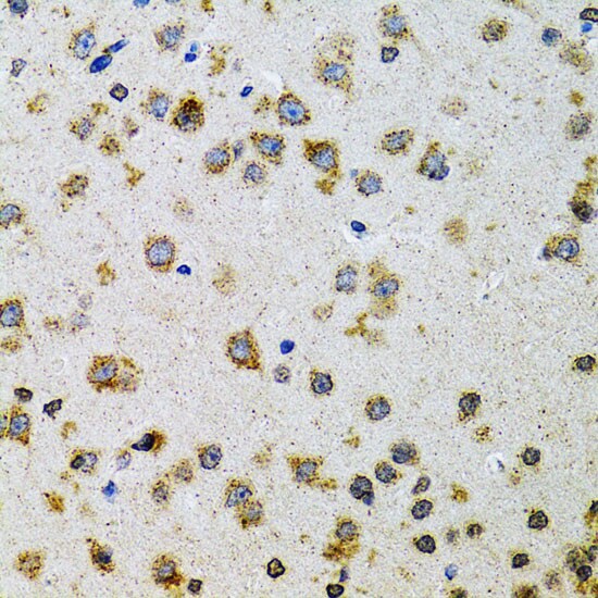 Prodynorphin/PDYN Antibody
