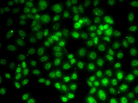 PRMT2 Antibody