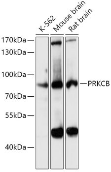 PKC beta Antibody