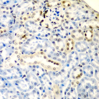 Deoxycytidylate deaminase Antibody