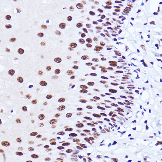 Matrin 3 Antibody