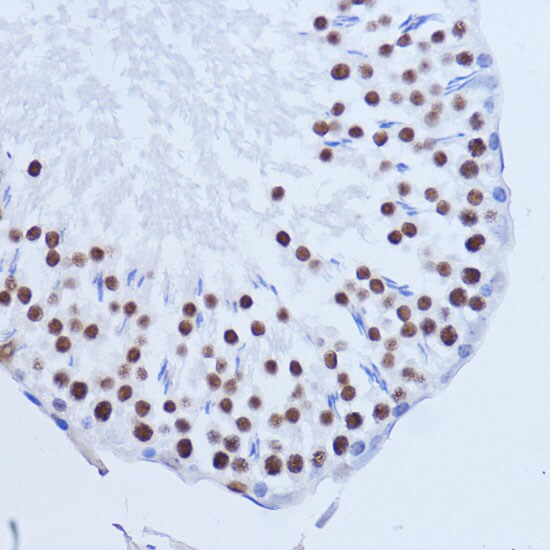 Matrin 3 Antibody