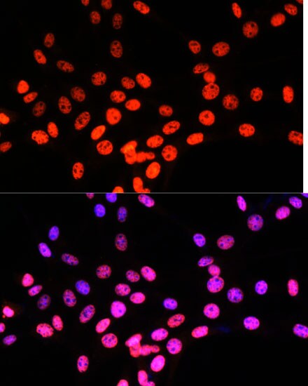 Matrin 3 Antibody