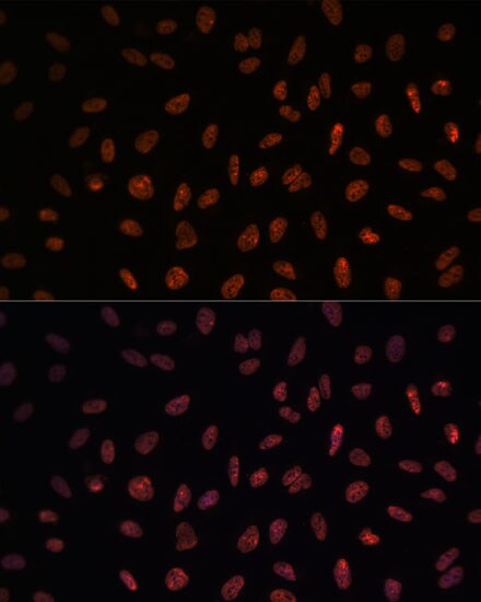 Matrin 3 Antibody