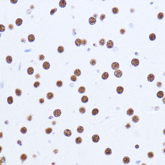 Matrin 3 Antibody