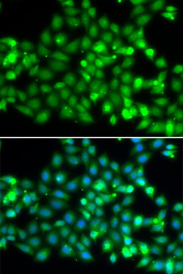 RNF36 Antibody