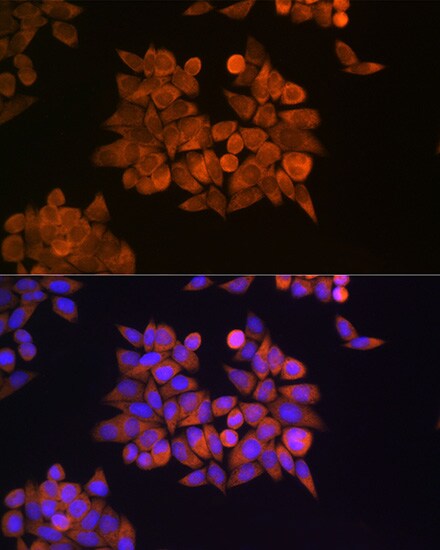 eRF1 Antibody