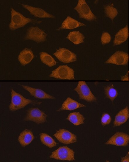 CSDE1 Antibody