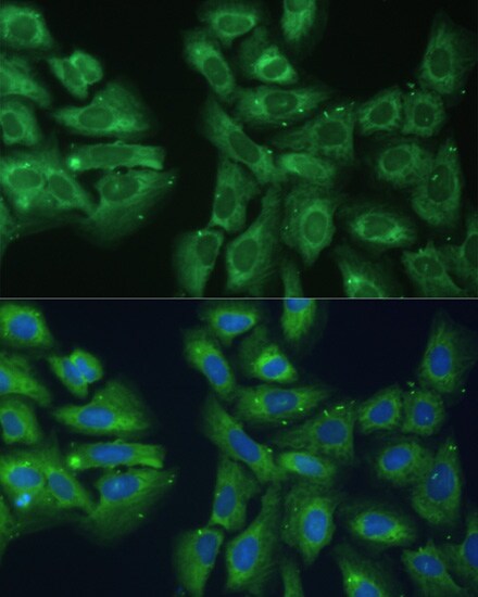EIF3D Antibody