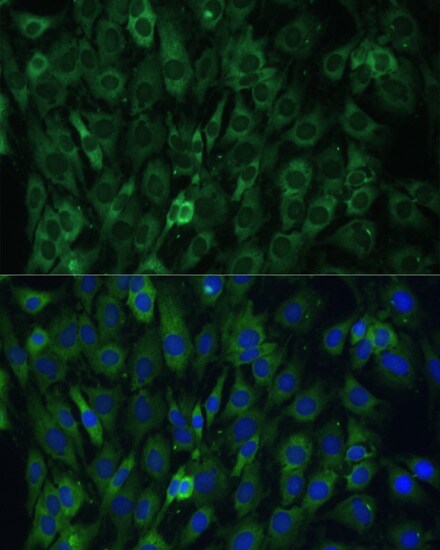 EIF3D Antibody